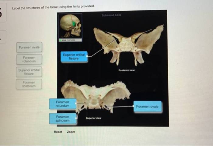 Label the structures of the bone using the hints provided.