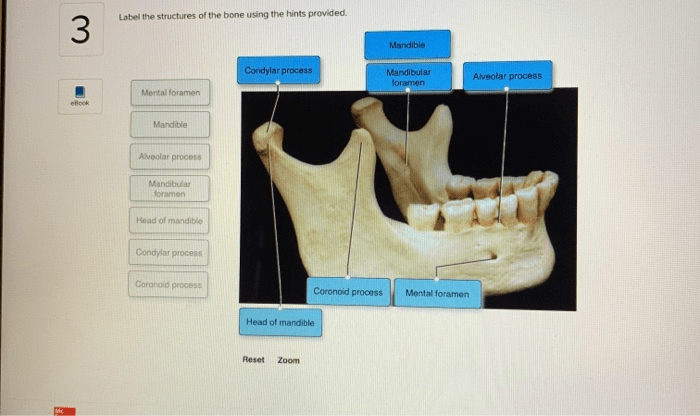 Structures hints epiphyseal solved cartilage transcribed problem